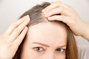Causes of white hair